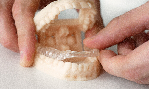 zahnschiene-funktionsdiagnostik-ried-im-innkreis